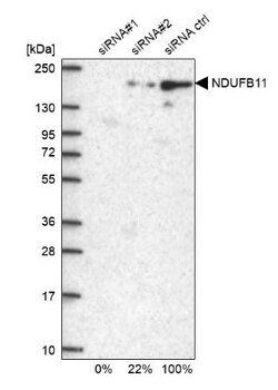 NDUFB11 Antibody, Novus Biologicals:Antibodies:Primary Antibodies